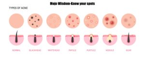 Know your spots Medicalmojo.co.uk