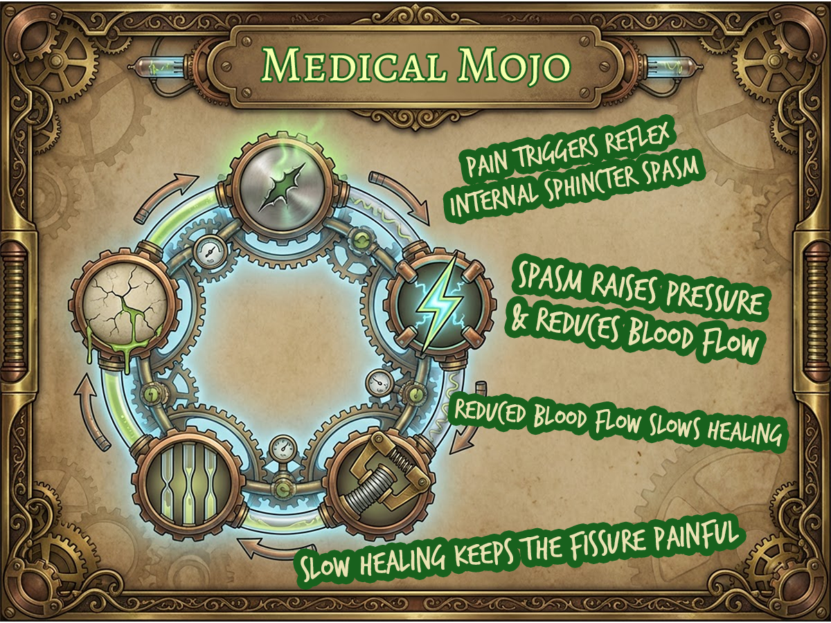 A steampunk gear loop illustrates the pain–spasm cycle of anal fissure, showing tear, pain, spasm, reduced blood flow, and slow healing at medicalmojo.co.uk